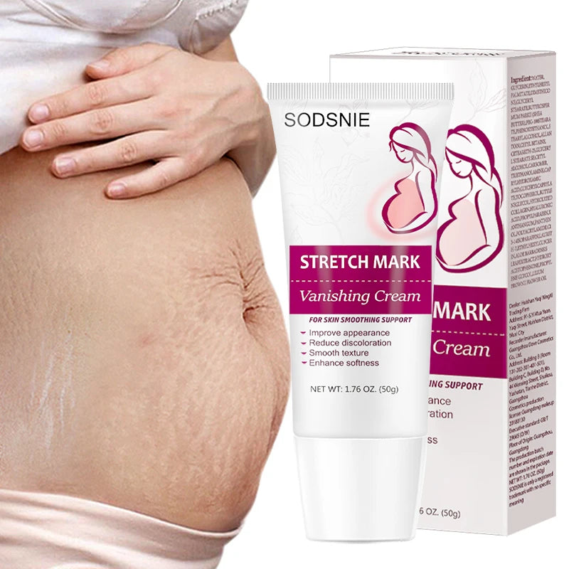 Stretch Mark Vanishing Cream Remove Body Buttock Breast Marks Effective Treatment Repair Maternity Loose Firming Skin Care 50g