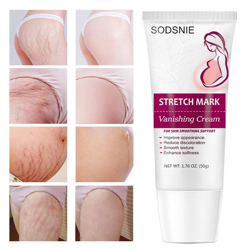Stretch Mark Vanishing Cream Remove Body Buttock Breast Marks Effective Treatment Repair Maternity Loose Firming Skin Care 50g