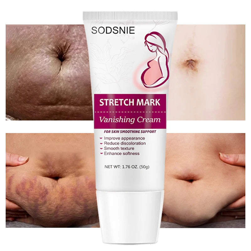 Stretch Mark Vanishing Cream Remove Body Buttock Breast Marks Effective Treatment Repair Maternity Loose Firming Skin Care 50g